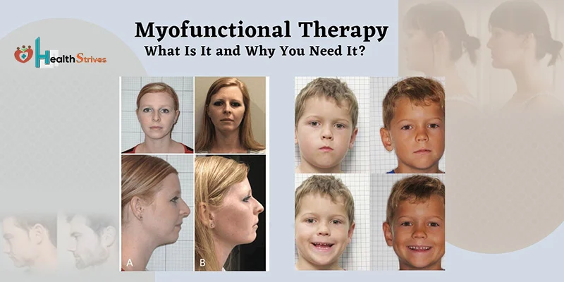 Myofunctional Therapy in Toronto: What Is It and Why You Need It?