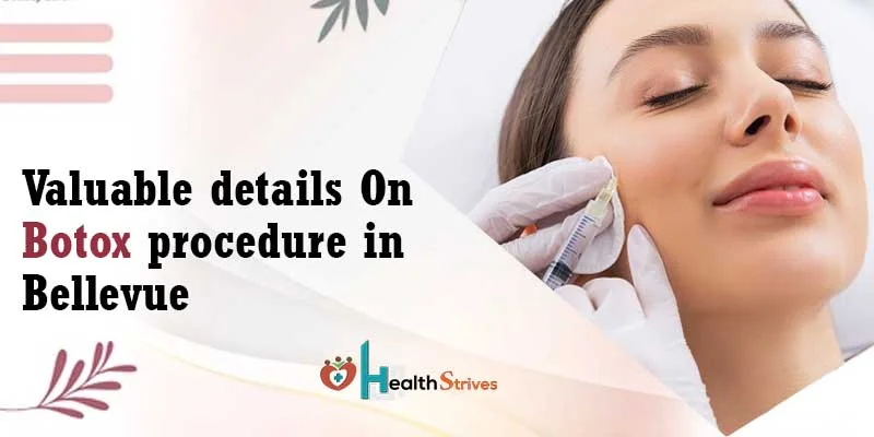 Valuable Details On Botox Procedure In Bellevue