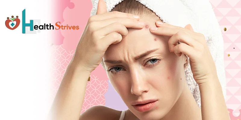Forehead Pimples Reason And How To Prevent It