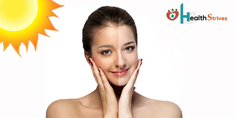 How To Remove Tan From Face Quickly: Tips And Tricks