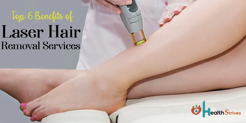 Top 6 Benefits of Laser Hair Removal Services