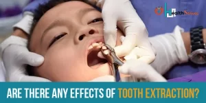 Are There Any Effects of Tooth Extraction
