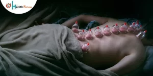 Power Of Suction Cups: Benefits Of Cupping